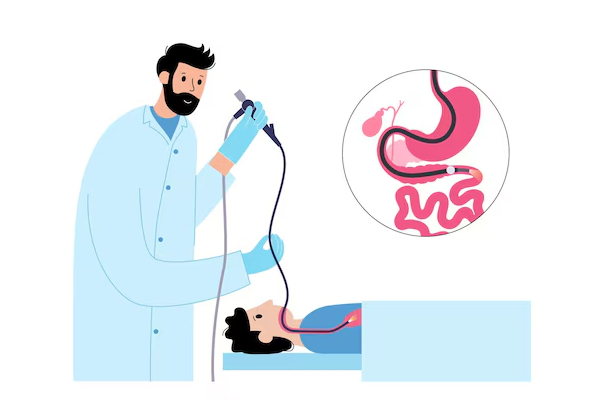 Upper GI Endoscopy