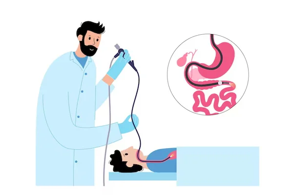 Upper GI Endoscopy